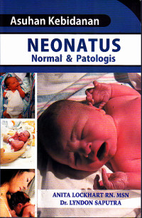 Image of Asuhan Kebidanan : Neonatus Normal & Patologis